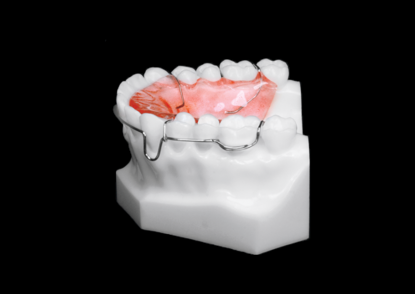 Circumferential Retainer (Upper) view 3